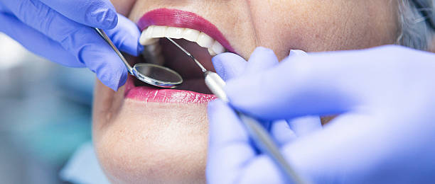 Best Emergency Treatment for Dental Infections or Abscesses in Thomson, GA